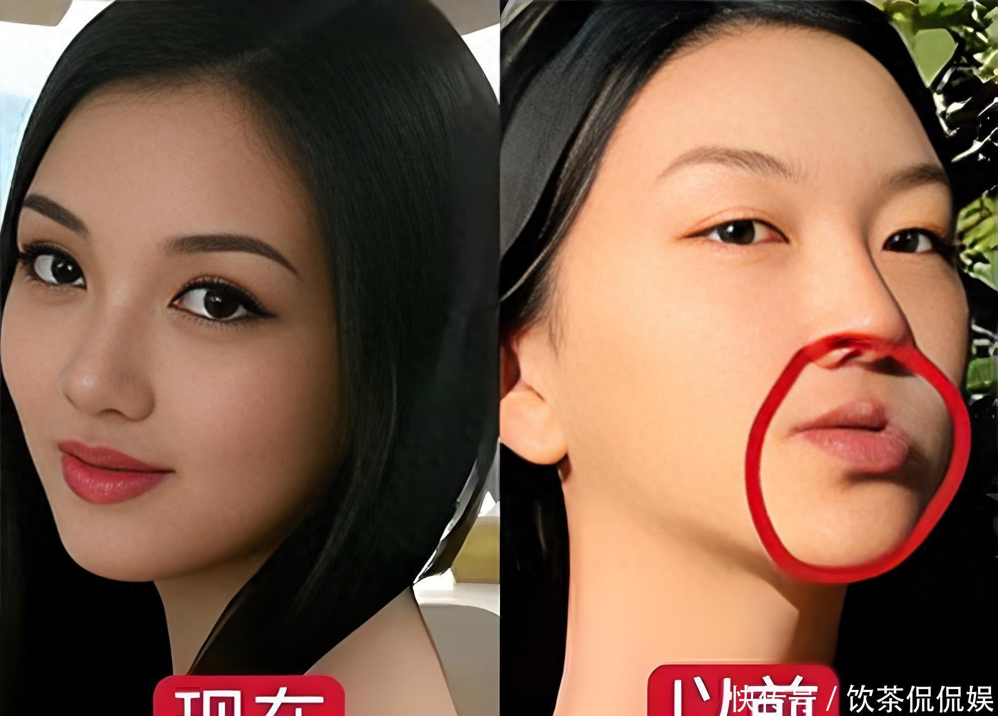 19岁王菲女儿李嫣现身北京，昔日“兔唇女孩”逆袭成清冷女神 - 360娱乐，你开心就好