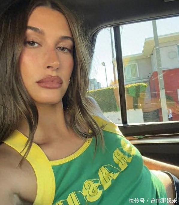 比伯妻子Hailey播客封神：30岁前不打肉毒，敢逆好莱坞风气 - 360娱乐，你开心就好