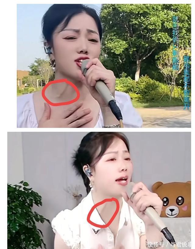 网红歌手段煜突发脑溢血，昏迷二十三天去世，脑出血前身体有异样 - 360娱乐，你开心就好
